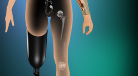 Become a medical engineer! Become a medical engineer!